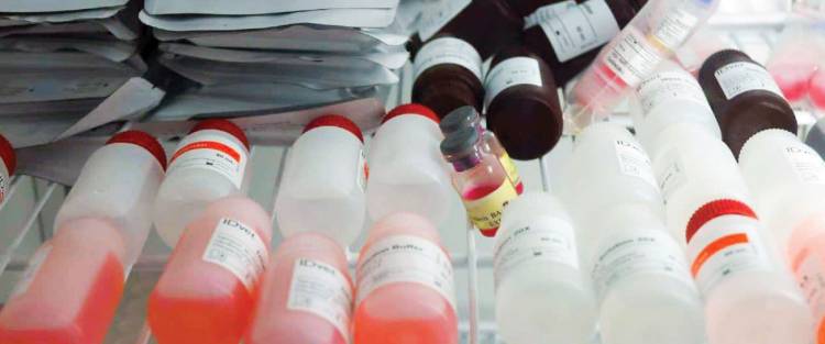 التحاليل الطبية.. أسعارها مؤلمة … أصحاب مخابر : ارتفاع الأسعار مرتبط بصعوبة تأمين مواد فحص العينات المخبرية